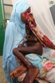 Somalie - Camp de réfugiés - Famine -7008.jpg