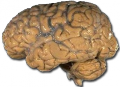 Cerveau humain-encephale-encéphale.png