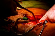 Surgical Operative Photography-9077.jpg