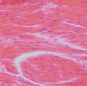 Glatte Muskelzellen (1).jpg